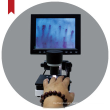 Biobase China WXH-12 Coaxial coarse/ Slightly Adjusted Microcirculation Microscope For Individual Microcirculation Monitoring